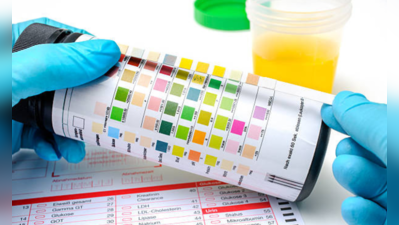Urine Colour